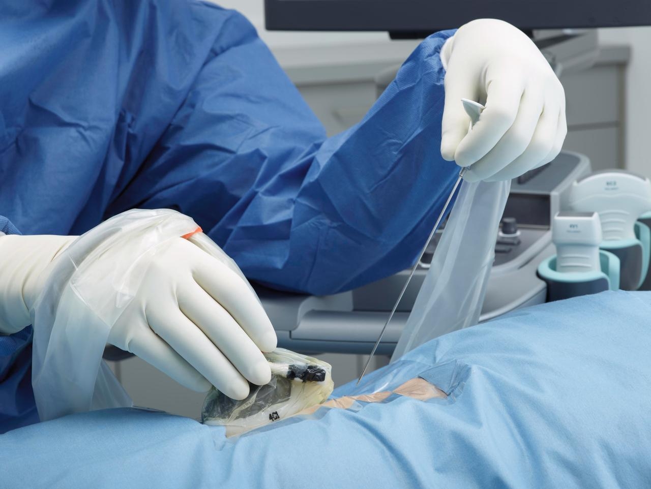 биопсия молочной железы