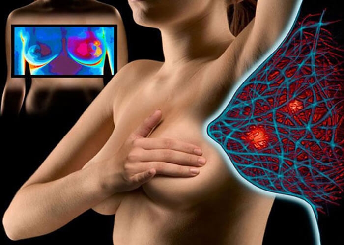 когда надо делать маммографию