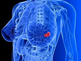 как часто надо делать маммографию