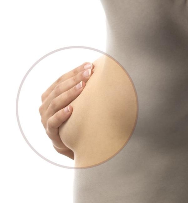 выделения из молочной железы