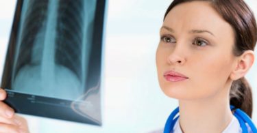 флюорография при грудном вскармливании