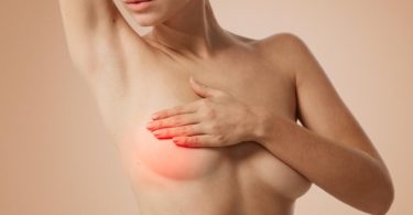 киста молочной железы