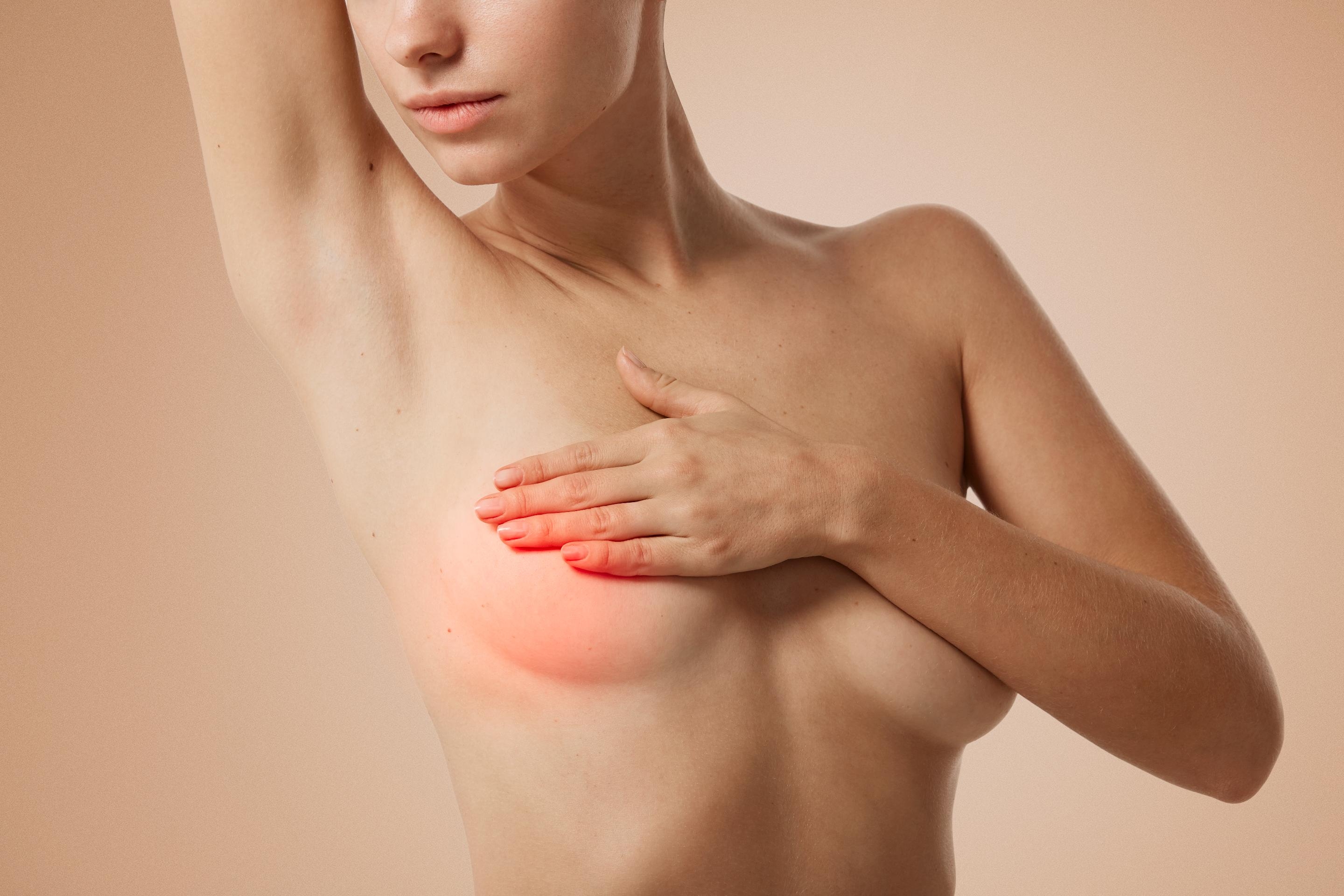 симптомы воспаления груди у женщин фото 61