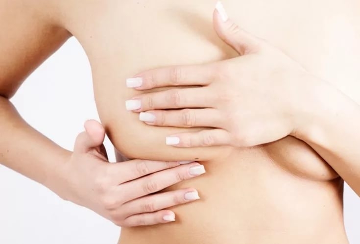 профилактика мастопатии