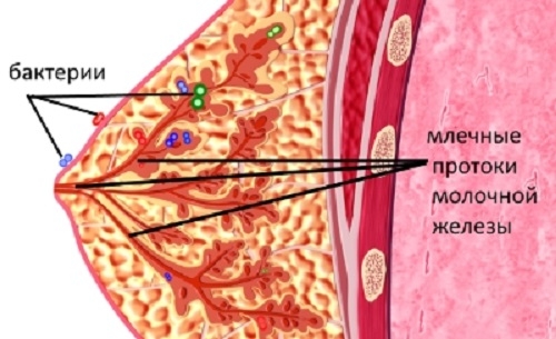 мастит симптомы