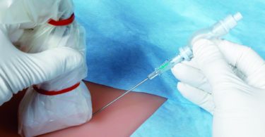 пункция молочной железы