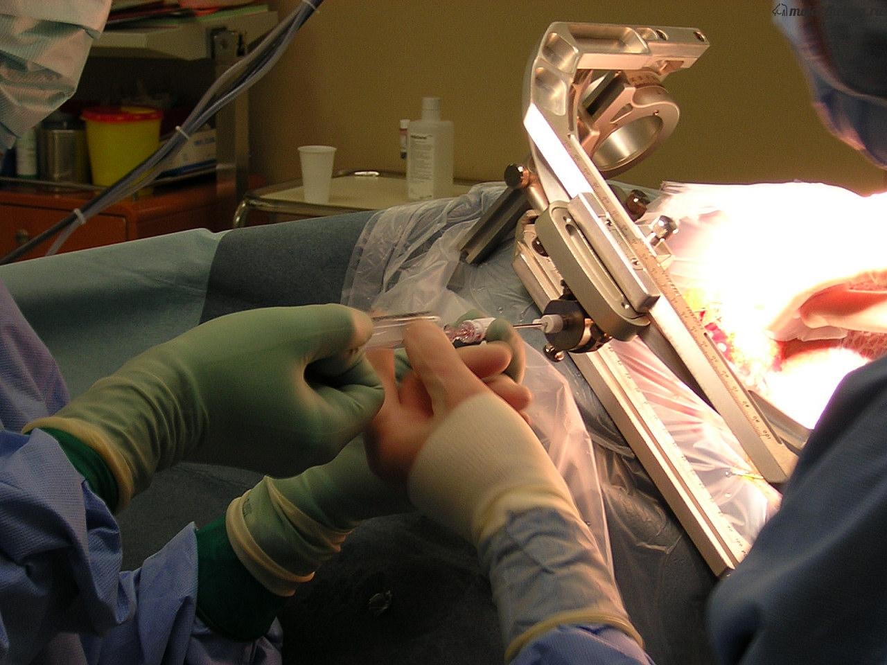 пункция молочной железы