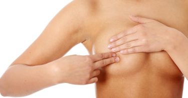 уплотнения в молочных железах