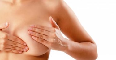 дуктэктазия молочной железы что это такое