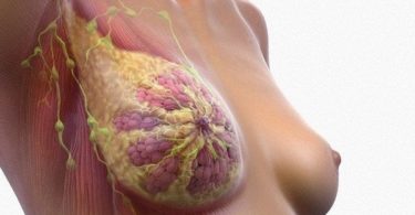 инвазивный рак