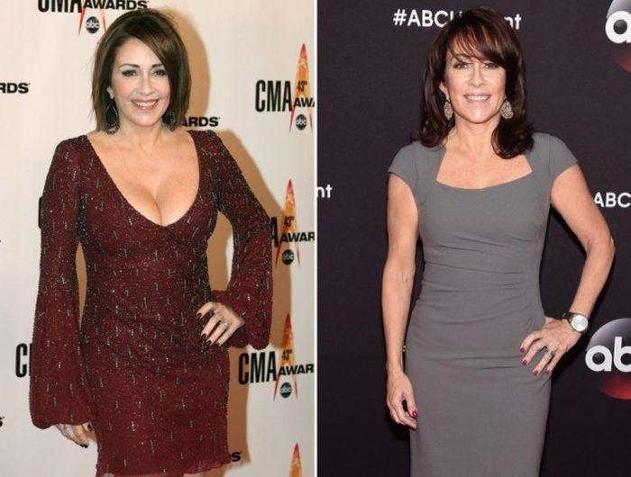 коррекция груди