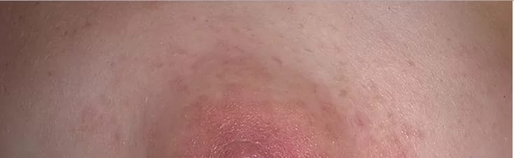 красные пятна