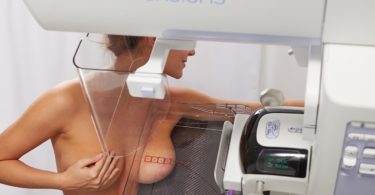 маммография молочных желез