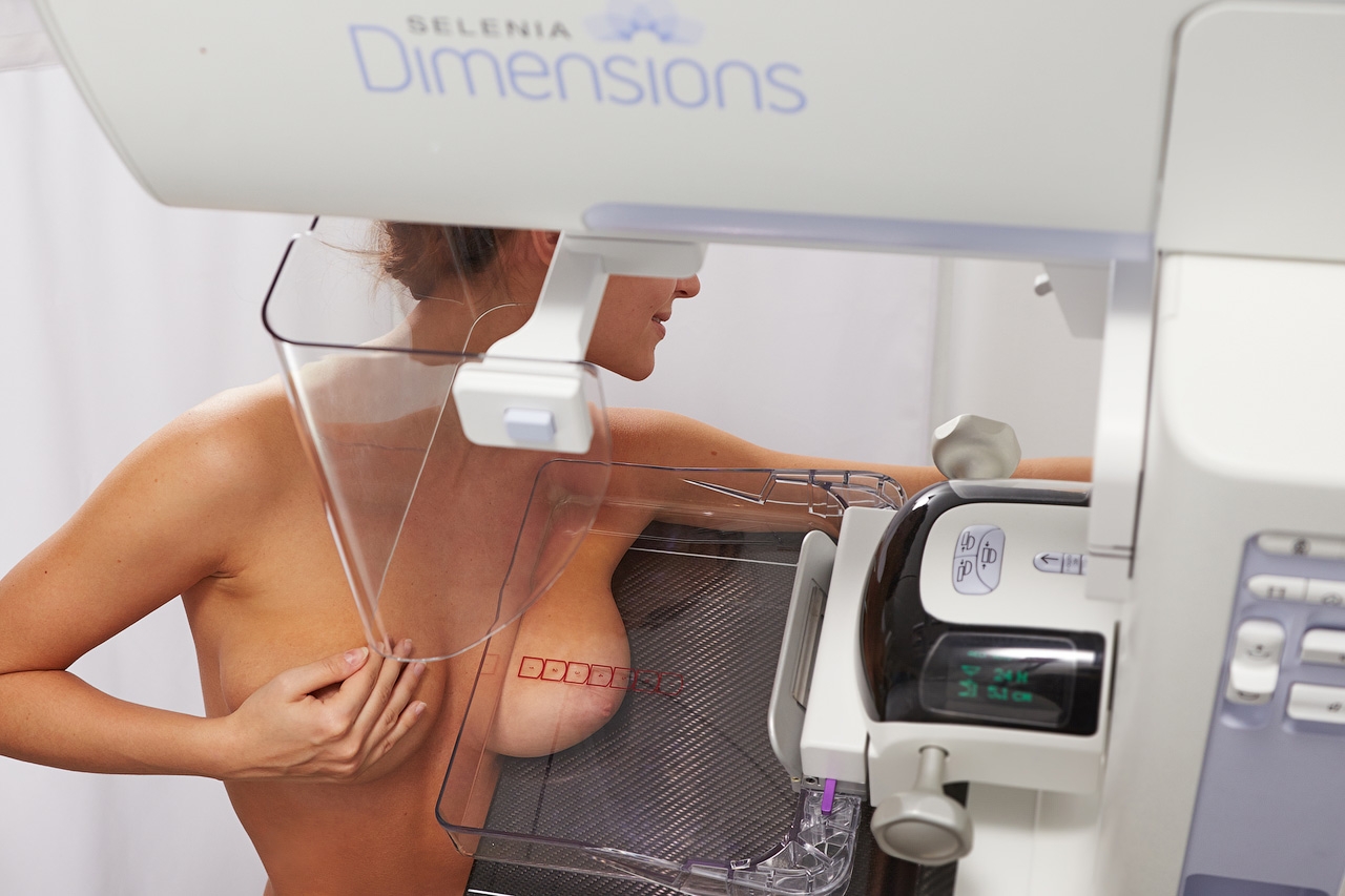 что такое маммография женской груди (120) фото
