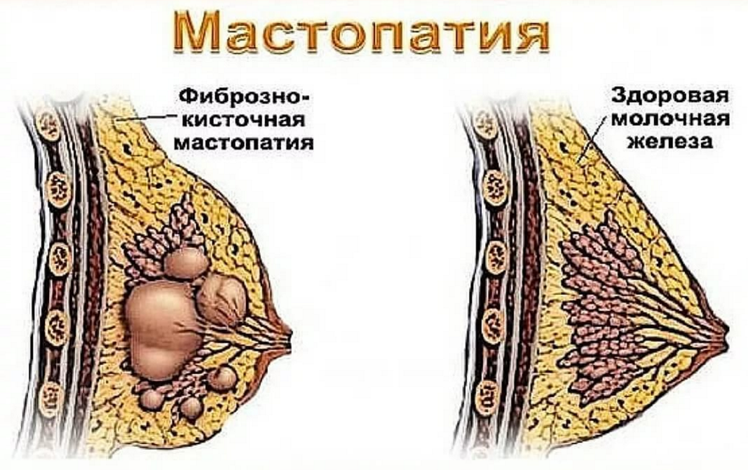 Мастодинон лекарство инструкция