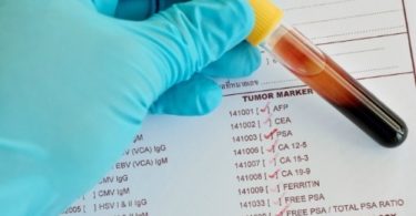 онкомаркер молочной железы