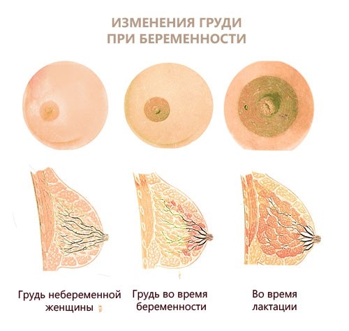 выделения из груди