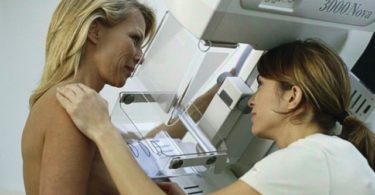 железистая ткань